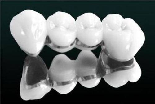 三、拔牙后口腔清洁护理细节