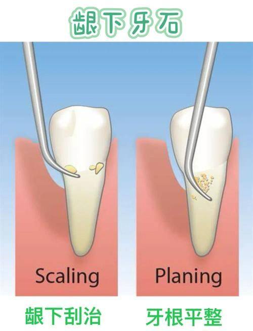 江苏镇江佐德口腔预约挂号方式
