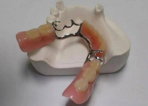 三、哪些情况洗牙无法改善牙齿发黄