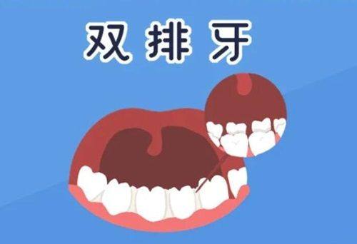 二、日常习惯调整:从根源改善地包天诱因