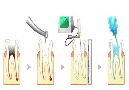 滁州博雅口腔医生名单及擅长领域: