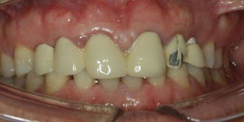 浙江绍兴上虞开元口腔诊所怎么样？