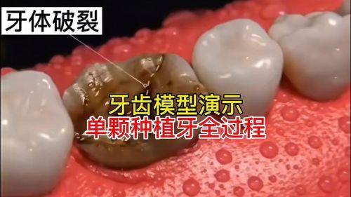 诸城李凤娟口腔诊所怎么样？