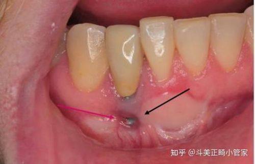 重庆罗霞口腔怎么样？