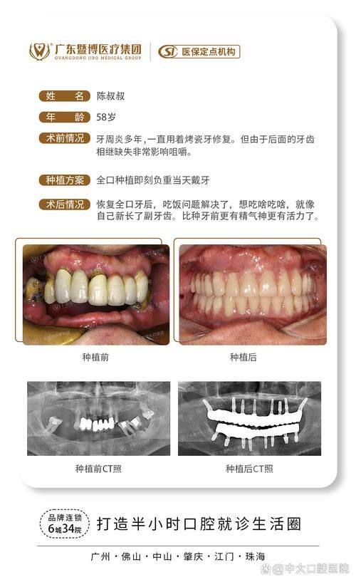滁州博雅口腔怎么样?