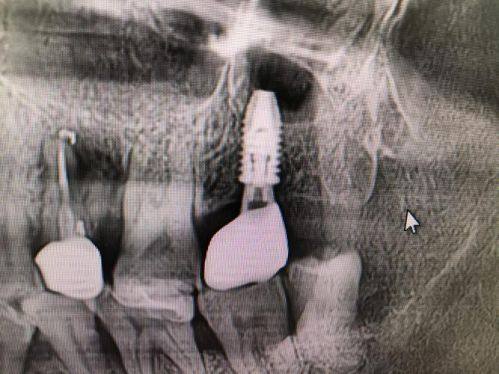 滁州博雅口腔预约挂号方式