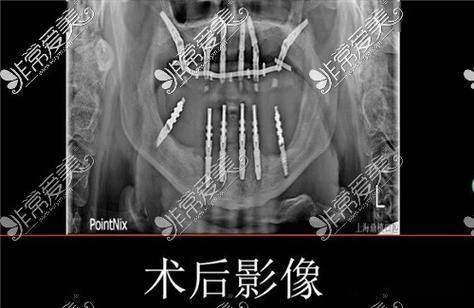 张士杰医生怎么预约