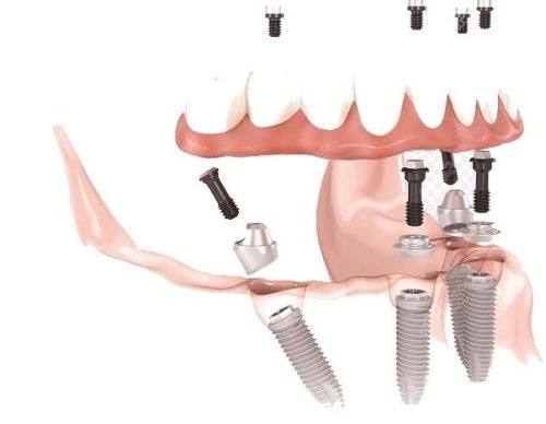 滁州博雅口腔地址电话及营业时间