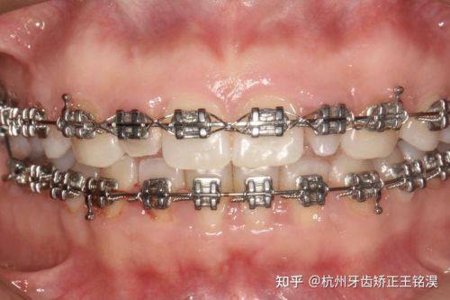 苏州国香园口腔预约挂号方式：