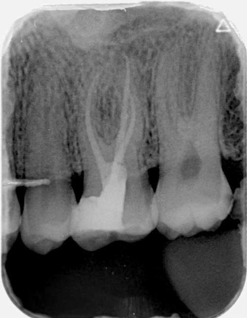 滁州博雅口腔口碑评价