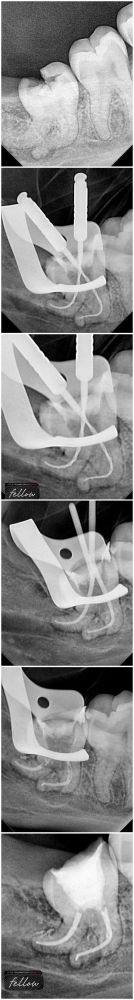 宝鸡市牙卫士口腔门诊部预约挂号方式：
