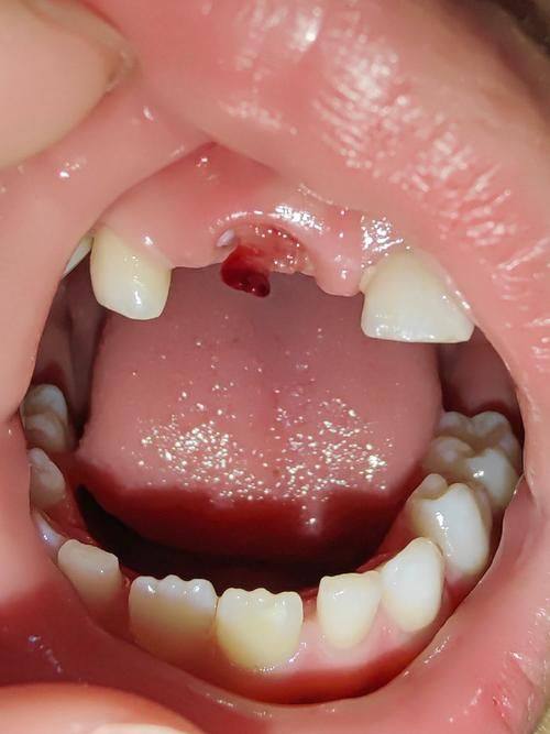 易征宇医生技术优势