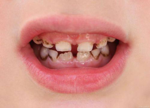 诸城李凤娟口腔诊所擅长项目：