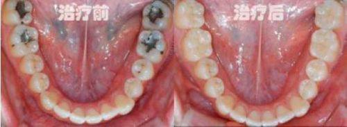 湖南长沙聪林口腔擅长项目：