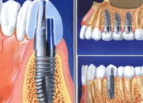七、青少年根管治疗的机构选择建议