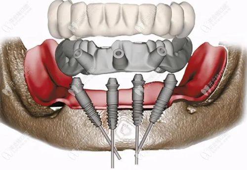 耿永铅医生口碑评价