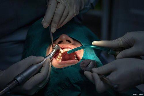 随丽娜医生技术优势