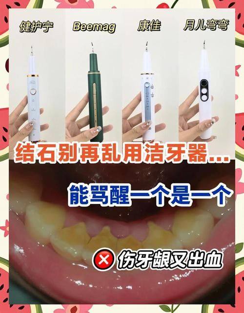 深圳新张近新口腔诊所擅长项目：