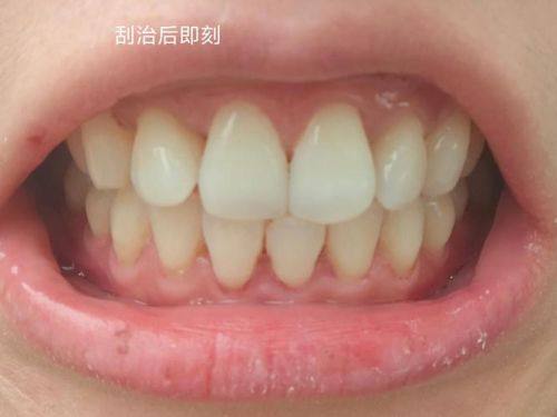 山东潍坊昌邑邑城口腔擅长项目：