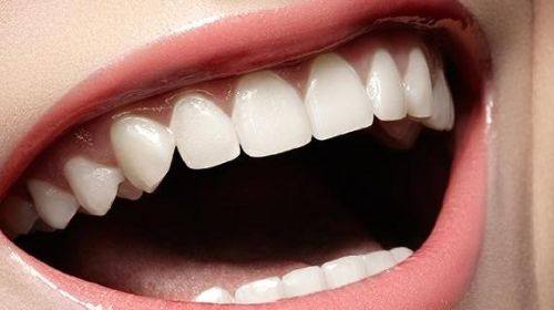 湖北荆州松滋亚美尔口腔擅长项目：