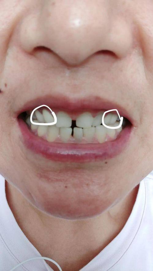 陶波医生怎么预约