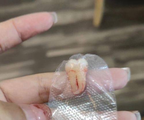 威海宋宇口腔擅长项目