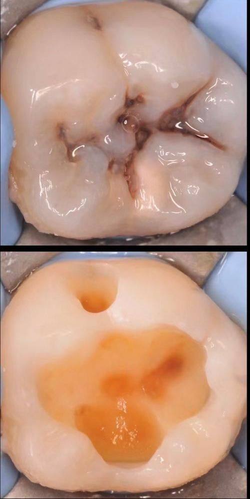 深圳新张近新口腔诊所怎么样？