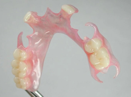 四、二氧化锆全瓷牙结实吗?硬度带来的临床优势