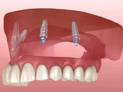 四、拔牙是口腔科还是口腔外科?误区辨析