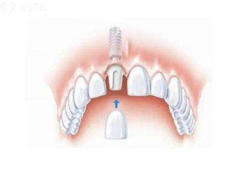 江苏泰州泰兴羌溪口腔预约挂号方式