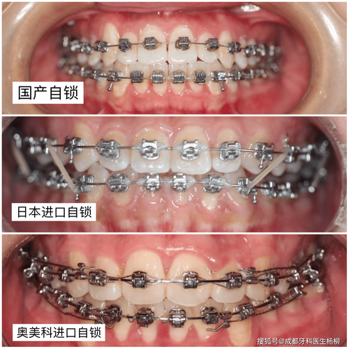 山东菏泽冀晨口腔口碑评价:
