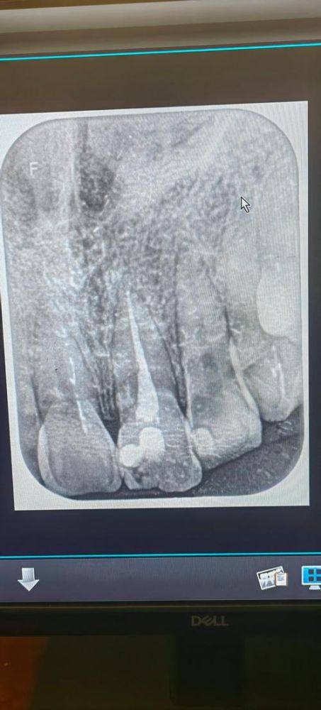 哈尔滨医博卫仕口腔门诊价格表: