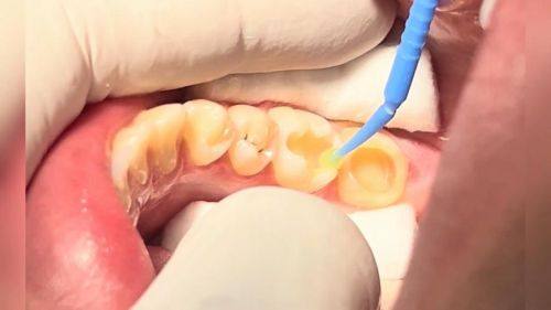 天门市竟陵平勇口腔门诊部地址电话及营业时间: