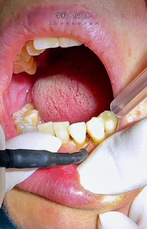 哈尔滨医博卫仕口腔门诊预约挂号方式: