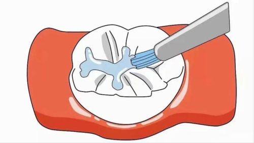 南京瑞齿固德口腔门诊部价格表：