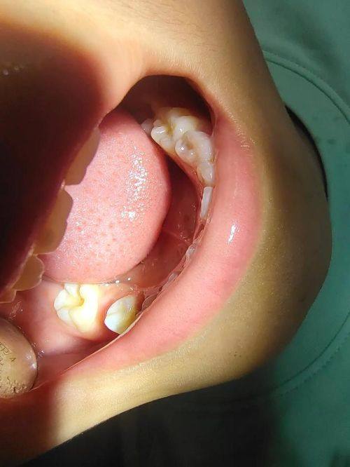 哈尔滨医博卫仕口腔门诊怎么样?