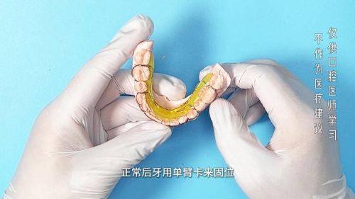 江苏无锡罗宇口腔诊所擅长项目：