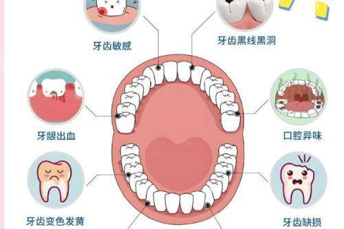 五、即刻种植的收费明细