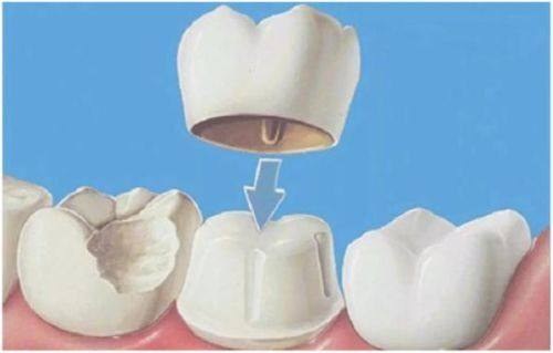 广东揭阳吴氏口腔诊所价格表：