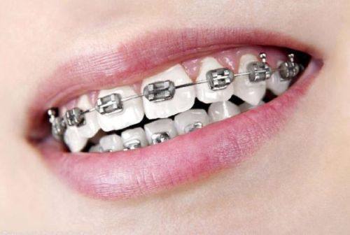 三、全瓷牙能用多久时间不疼的前提