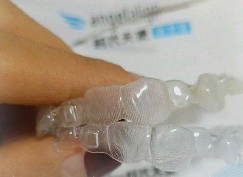 五、不同场景下全瓷修复体的寿命差异