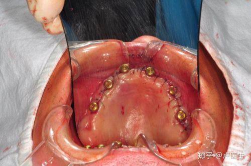 耿永铅医生怎么预约