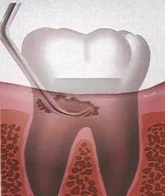 广东揭阳吴氏口腔诊所口碑评价：