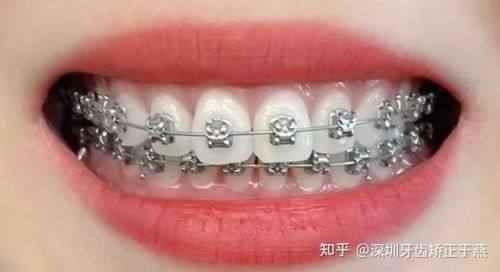 自贡富顺康乐口腔门诊部口碑评价：