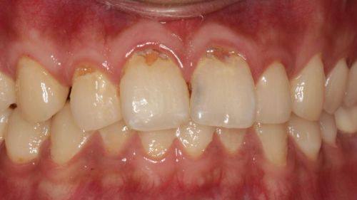 山西晋中平遥勇明齿科地址电话及营业时间
