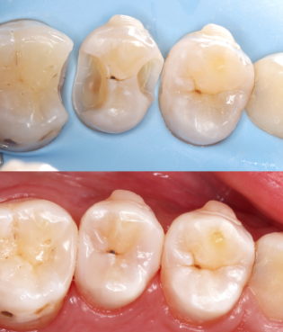 自贡富顺康乐口腔门诊部价格表：